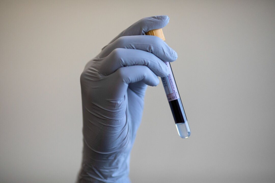 NHS Revolutionizes Lung Cancer Treatment with Groundbreaking Blood Test